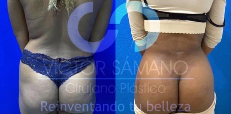 Slider image (9) Dr Victor Samano Plastic Surgery Cancun